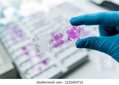 Hand In Blue Glove Holding Glass Histology Slides