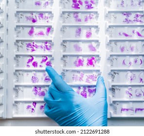 Hand In Blue Glove Holding Glass Histology Slides