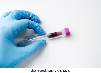 A Hand In A Blue Latex Glove Holds On A White Background A Test Tube Of A Purple Cap With Biological Material Blood. Infection With Coronovirus And Infections.