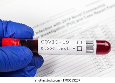 Hand In Blue Protective Surgical Medical Gloves Holding Test Tube With Patient Blood Sample, COVID-19 Coronavirus Testing Procedure, Real Time Reverse Transcription Polymerase Chain Reaction (RT-PCR)