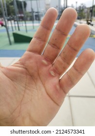 Hand With Calluses To Exercise In Calisthenics Park