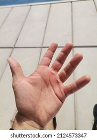 Hand With Calluses To Exercise In Calisthenics Park