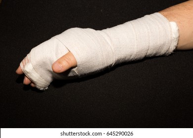 Hand Cast After Hand Surgery Stock Photo 645290026 | Shutterstock