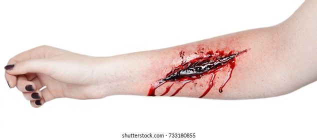 
A Hand Is Cut Vein A Lot Of Blood Flowing Red Body Wound Pain Suturing Wound Suicide Photo On White Background Professional Make-up Artist Draws Special Effects For Film Make-up