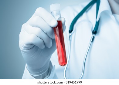 Hand Of A Doctor Holding A Bottle Of Blood Sample