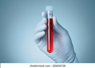 Hand Of A Doctor Holding A Bottle Of Blood Sample