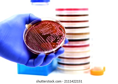 Hand Of A Doctor Or Researcher Holding A Culture Of The Bacterium Enterobacter Cloacae Growing On A Selective Medium Called Eosin Methylene Blue Agar (EMB Agar)