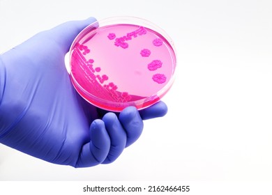 Hand of a doctor or researcher with a plate culture of pink microorganisms