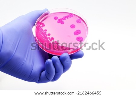 Hand of a doctor or researcher with a plate culture of pink microorganisms
