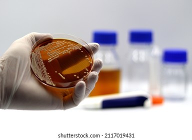 Hand of a doctor or researcher with white gloves holding a plate of the probiotic yeast Saccharomyces boulardii - Powered by Shutterstock