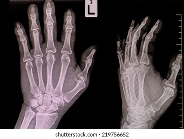 Hand Xray View Healthy Palm Xray Stock Vector (Royalty Free) 542942275