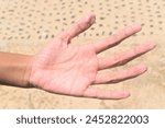 Hand fingers get wrinkly after soaked in sea water