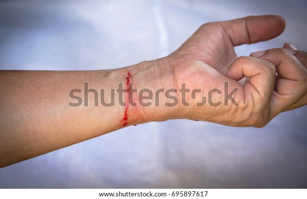 Hand Full Blood Wrist Cut By Stock Photo Edit Now
