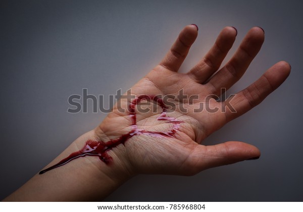 Hand full of blood and wrist cut. suicide of unhappy love.