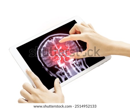 The hand gestures towards a tablet displaying detailed  of MRI brain Coronal T2W with Cerebral artery fusion image isolated on white background. Clipping path.