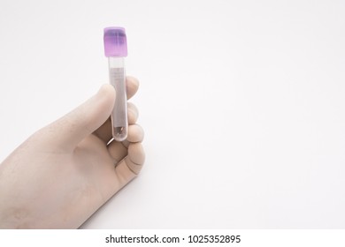 A hand with glove holding a blood test tube on isolated white background. - Shutterstock ID 1025352895