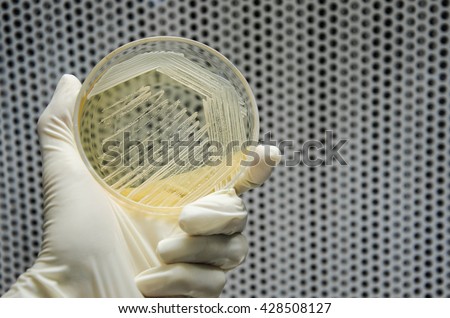 Hand in glove is holding a petri dish of cross streak of Saccharomyces cerevisiae (baker yeast) growing on yeast extract peptone dextrose agar plate. microbiology laboratory test.