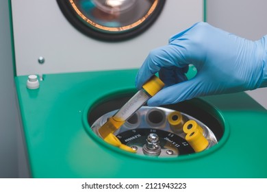 Hand In Glove Inserts Tube With Urine Into Medical Centrifuge To Separate It Into Fractions For Testing