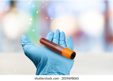 Hand Holding Blood Sample Tube. Blood Sample For Coagulation Test In The Hematology Laboratory