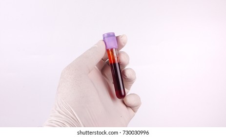 Hand holding blood sample in vacuum tube isolated on white