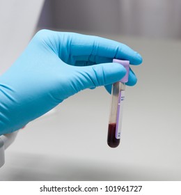 Hand Holding Blood In Test Tube