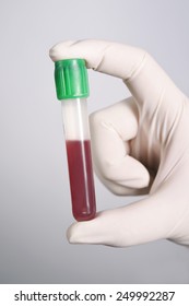 Hand Holding Blood Test Tube On Stock Photo 249992287 | Shutterstock