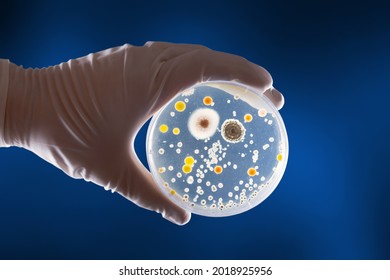 Hand Holding Culture Plate Of Bacterial Growth On A Background