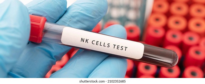 Hand Holding A Glass Of Test Tube With Patient's Blood For Testing NK Cells Test