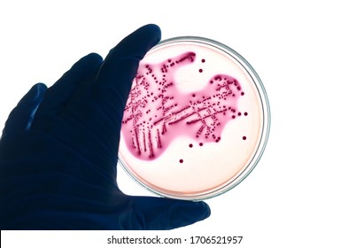 Hand holding MacConkey agar plate which contain pink colonies of lactose fermenting bacteria, E. coli