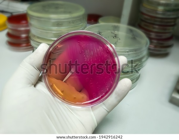 Hand holding MacConkey agar\
plate which contain pink colonies of lactose fermenting bacteria,\
E. coli