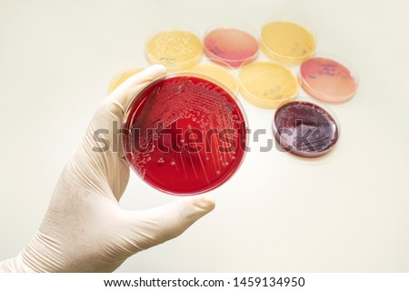 Hand holding petri dishes with Escherichia coli (E.coli), coliform culture in macconkey agar. Bacterium culture growth in plate. Medical tests or laboratory experiment concept.
