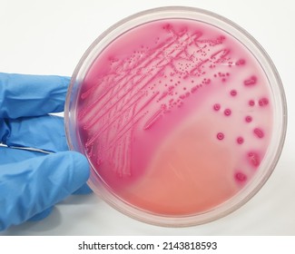 Hand holding plate with Pink-purple bacterial colonies of Escherichia coli in MacConkey Agar plate - Shutterstock ID 2143818593