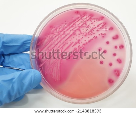 Hand holding plate with Pink-purple bacterial colonies of Escherichia coli in MacConkey Agar plate