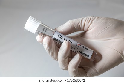 Hand Holding Positive Marked Corona / Covid 19 Test Tube 