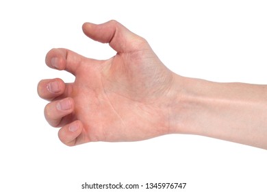 Small White Spots On Arms Idiopathic Stock Photo 1916795462 Shutterstock Small White Spots On Arms Idiopathic Stock Photo 1916795462 Shutterstock