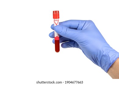 Hand Holding Test Tube With Blood Plasma Ready For Testing.