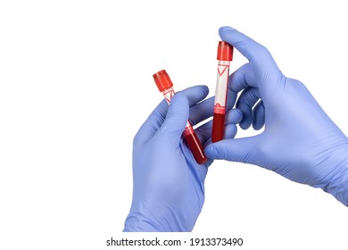 Hand Holding Test Tube With Blood Plasma Ready For Testing.