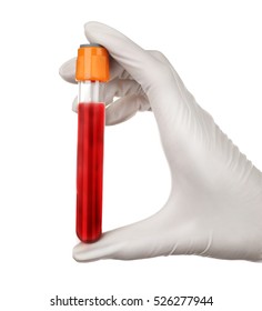 Hand Holding Blood Test Tube Close Stock Photo 8856232 | Shutterstock