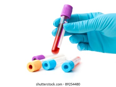 Hand Holding Test Tube With Blood Plasma Ready For Testing