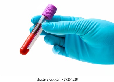 Hand Holding Test Tube With Blood Plasma Ready For Testing