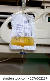 Hand holding urine or pee catheter bag hang under patient bed in hospital