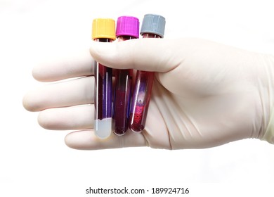 Hand Holding Vacuum Venipuncture Test Tube