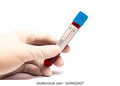 Hand Holding Vial With Blood On White Background