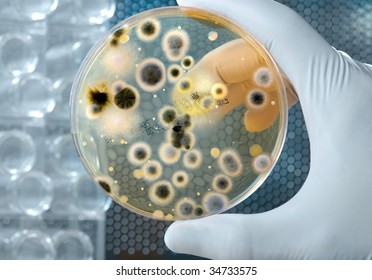 Hand Holds Petri Dish with Bacteria Culture - Shutterstock ID 34733575