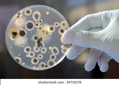 Hand Holds Petri Dish With Bacteria Culture