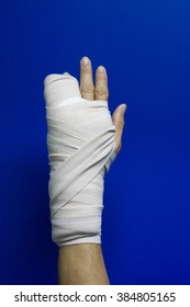 Hand Injury Bone Fracture Finger Accident Stock Photo 384805165 ...