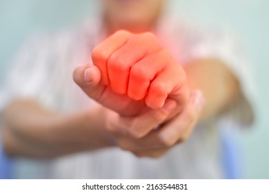 Hand Joints Inflammation. Concept And Idea Of Rheumatic Arthritis, Gout, Joint Swelling Or Arthralgia.