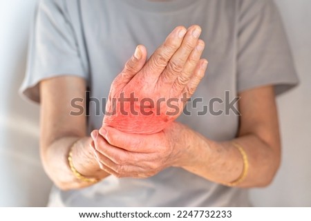 Hand joints inflammation. Concept and idea of rheumatic arthritis, rheumatism, gout, joint swelling or arthralgia.