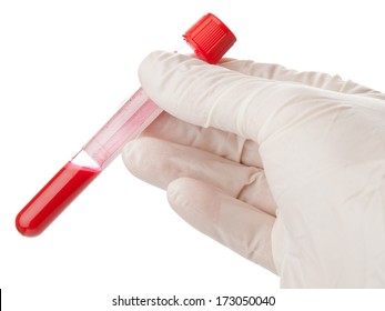 Hand With Latex Glove Holding Blood Sample Vial Isolated On White Background