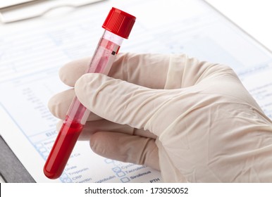 Hand With Latex Glove Holding Blood Sample Vial In Front Of Blood Test Form